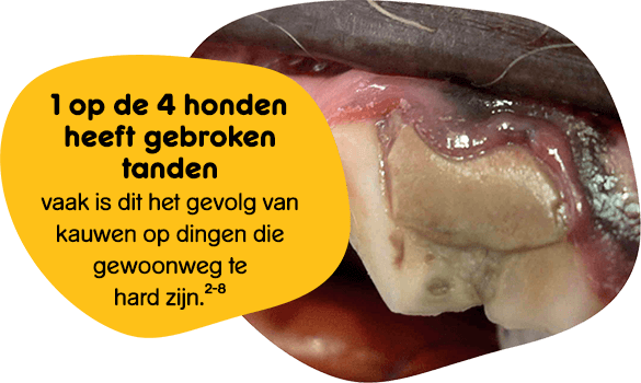 Fractured premolar tooth